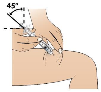 Drugom rukom držite štrcaljku (poput olovke) pod kutem od 45 stupnjeva u odnosu na kožu.