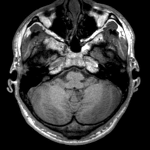 RMH Neuropathology,