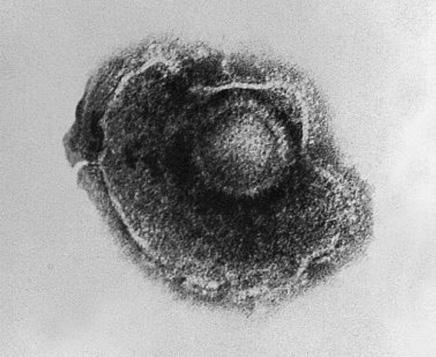 Vėjaraupių epidemiologijos, klinikos ir profilaktikos metodinės rekomendacijos Vėjaraupių epidemiologija Etiologija Vėjaraupių sukėlėjas Varicella zoster virusas (VZV).