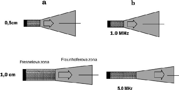 Aksialna i lateralna rezolucija rezolucija određena figuracijom zvučnog polja mijenja se s dubinom u tkivu rezolucija ograničena s λ za 3,5 MHz 0,86 mm aksialna resolucija udaljenost dviju ravnina