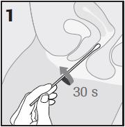 1. Dakrónovým tampónom odstráňte nadbytočný hlien z osi cervixu a okolia ektocervixu a tento tampón vyhoďte. 2.