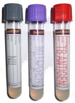 3.6. Odber vzoriek a transport materiálu na vyšetrenie QuantiFERON TB- Gold test 1. Odber sa robí venepunkciou do 3 skúmaviek s 3 rôznymi antigénmi.