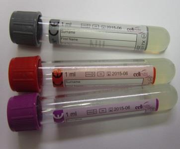 4. U pacienta je potrebné odobrať po 1ml venóznej krvi do každej z troch farebných QuantiFerónových skúmaviek.