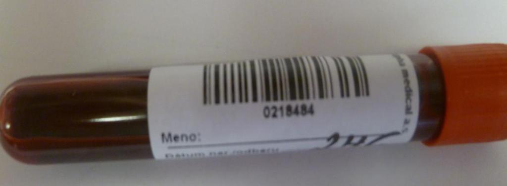Postup pre nalepenie čiarového kódu: 1. Napíšte meno pacienta na nálepku. Text nesmie zasahovať do čiarového kódu! 2. Ľavú časť etikety nalepte 1-2 cm od horného okraja skúmavky. 3.