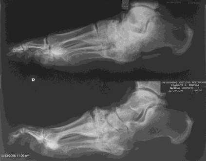 deformity