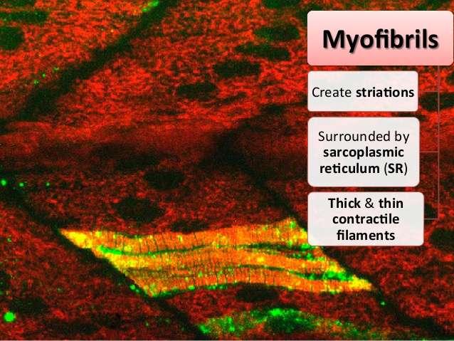 Miofibrillas Veido svītrojumu Apkārt sarkolpazmatiskais retikulums (SR) Sarkomērs miofibrillas saraušanās