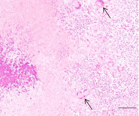 Estrutura de la presentación Estructura Introdución á tuberculose bovina (TB) Evolución do programa