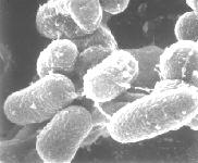 africanum M. microti M. pinnipedi M. Canetti ( ) (Murray et al., 1990; Collins, 2001; Acevedo-Whitehouse et al.