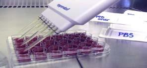 Intradermotuberculinización (IDTB) Gamma interferon