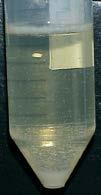 humoral ELISA TB Estudo histopatolóxico +