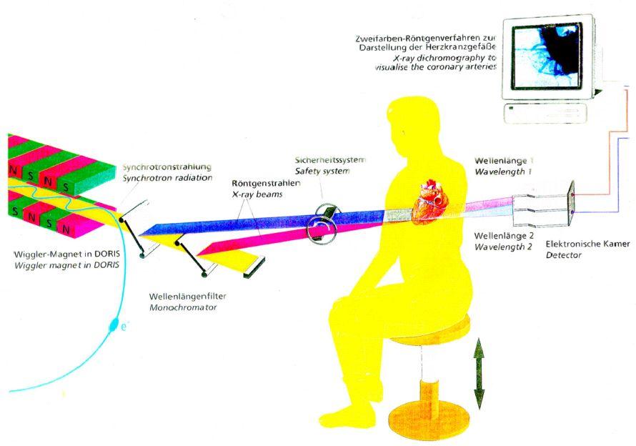 Applications in Medicine Interplay between Physics and Technology :#1.-%.)#-6/".1$)+&'&6'"/M N,"'"%)/1'&()!)OB P )## 9A )( 9O @0#"(')100)&??&6'()=(&+)-%)$1/'-60&) +&'&6'"/()1/&)21(&+)"%)',&)&0&6'/"#1.