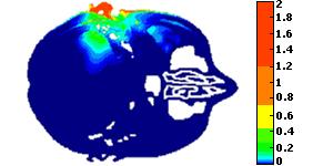 Omejitve seval emv Omejitve s stališča uporabnika: specifična vsrkana moč Specific Absorption Ratio SAR = (σ E 2 )/ρ