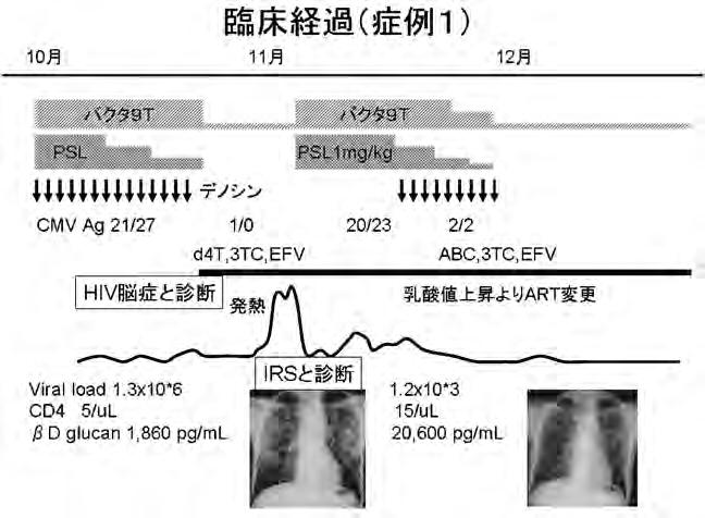 S Kimura et al : Symposium : Strategies for Better Results of HAART HIV HAART HIV AIDS IRS AIDS IRS IRS,**.,**0 *,01 AIDS 2, IRS AIDS HAART CD. HIV IRS AIDS2, PCP -/ +/ MAC 2 2 HIV /. IRS AIDS2, 0.