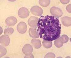 ne potječu od hematopoetske matične stanice koštane srži, već su mezenhimskog podrijetla u zametnim središtima sekundarnih limfnih folikula (limfnim čvorićima) receptori za Fc-ulomak i ulomke