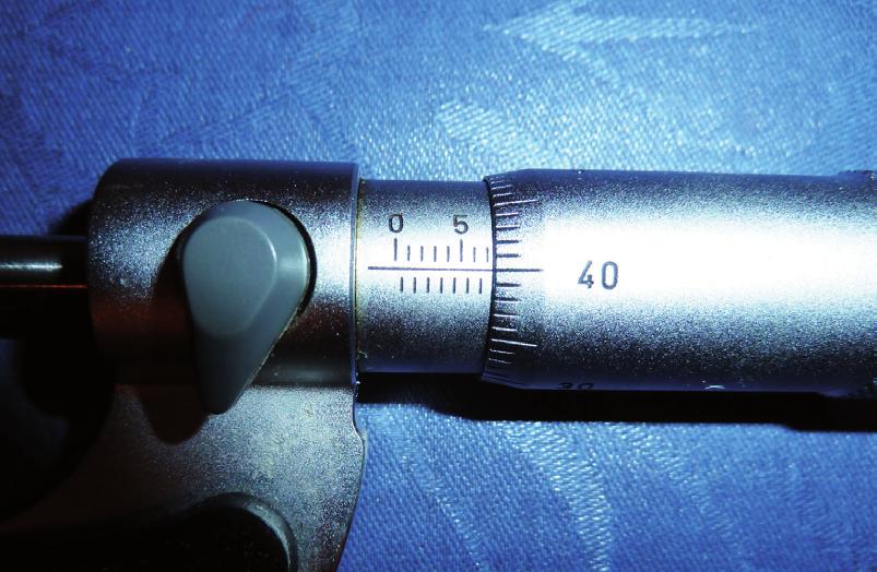 4. I dturgnamh chun friotachas an ábhair i sreang a thomhas, thomhais dalta trastomhas na sreinge cúig huaire ag áiteanna difriúla ar feadh na sreinge. Fuarthas na luachanna seo: 0.7 mm, 0.68 mm, 0.
