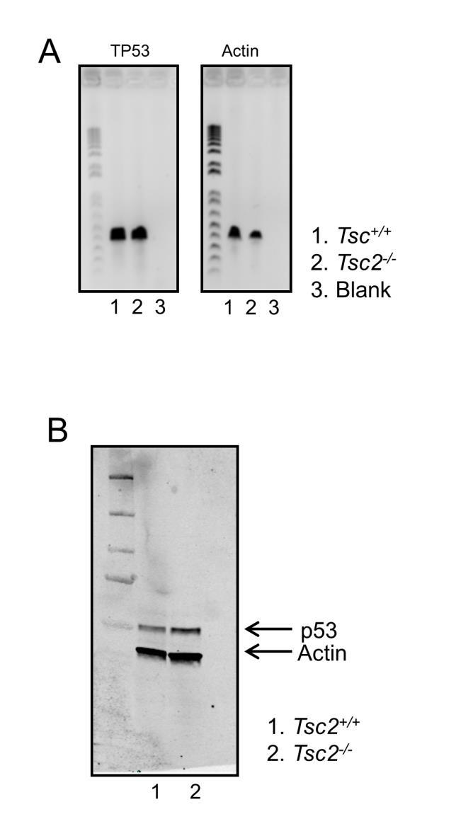 Supplementary Figure S2: Confirmation of p53 expression in Tsc2 -/- MEFs.