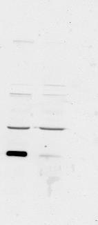However the image selected for p-p70s6 resulted from a longer exposure of the same blot.