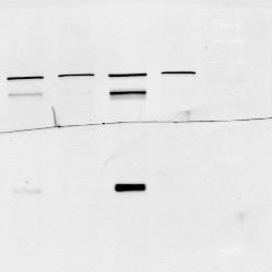 The p-pak blot was reprobed for actin to confirm equal protein concentration in the lysates.