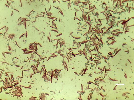 pelleted via centrifugation at 4,700 x g for 20 min. and washed with deionized water (x3). The obtained bacterial pellet was suspended sterile water and the vegetative forms of C.