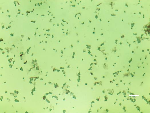 The washed pellet was resuspended in sterile water (10 ml) and layered on top of sterile 50% sucrose (in water). The gradient was centrifuged at 3,200 x g for 20 min.