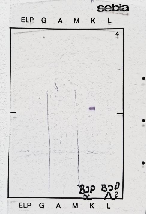 00 mg/l IFE Kapilarna elektroforeza Slika 9.