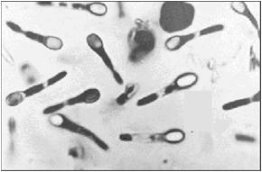 Habitat GENUL CLOSTRIDIUM intestinul animalelor şi al omului,