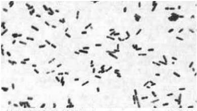 capetele rotunjite corpul bacterian deformat de endosporul mai mare