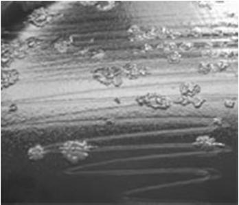 cultură Clostridium difficile, geloză sânge, incubare 18 ore, 37 0 C