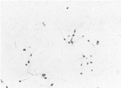 Rezistenţa faţă de factori fizici, chimici, biologici (sporii) fierbere Agentul fizic/chimic 105 C, căldură umedă glutaraldehida, dezinfectanți pe bază de halogeni formaldehidă, derivați fenolici