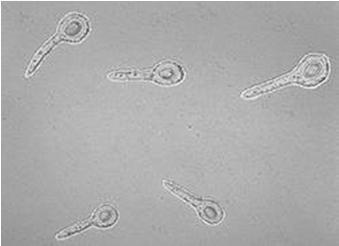 : C.perfringens, C.histolyticum, C.septicum, C.