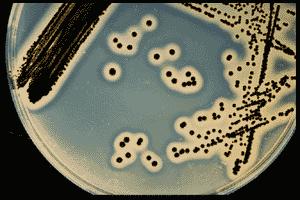 STAPHYLOCOCCUS AUREUS Baird Parker agar (ETPGA) E egg yolk, žumance jajeta (obogaćenje i aktivnost lecitinaze, lipaze T K-telurit, selektivni agens, inhibira G -,