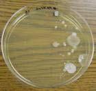 KVASCI I PLESNI Sabouraud agar selektivnost se postiže niskim ph (5,6) inhibicija većine vrsta bakterija dodatna