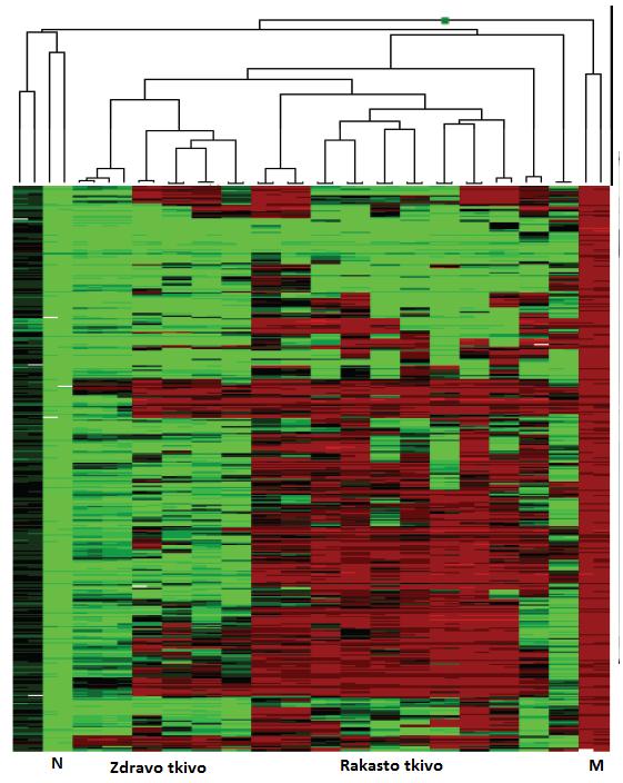 Rezultat vse-genomske analize: gen NORMAL 1 NORMAL 2 TUMOR 1 TUMOR 2 TUMOR 3 BLCAP 0.770115 0.7235704 0.9442897 0.9615089 0.9511719 TMEM25 0.2673522 0.3224146 0.
