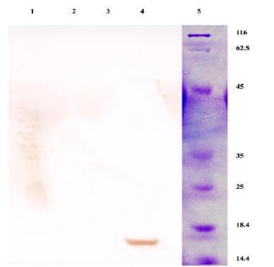 در این مطالعه به دلیل غلظت بسیار پایین پروتي ین تولیدي در سلولهاي MCF7 آزمایش وسترن بلاتینگ آن منفی شد این در حالی است که در رده سلولی CHO آزمایش ذکر شده مثبت گزارش شد (شکل 3). شکل 3.