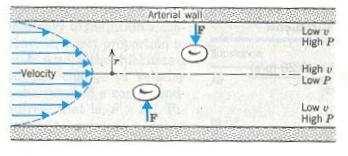 Brzina toka krvi u arteriji Pošto se brzina toka mijenja radijalno u krvnom sudu, to prema Bernulijevoj jednačini izlazi da će postojati i promjena pritiska u cijevi.