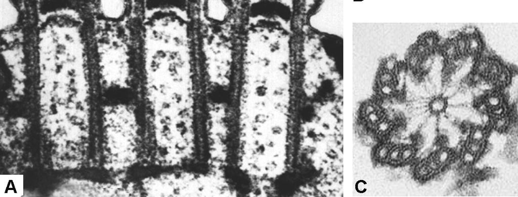 protozoe, spermatozoidi BAZALNO TELO organizacija 9X3 Pokretni ćelijski izraštaji, obavijeni ćelijskom membranom Srž
