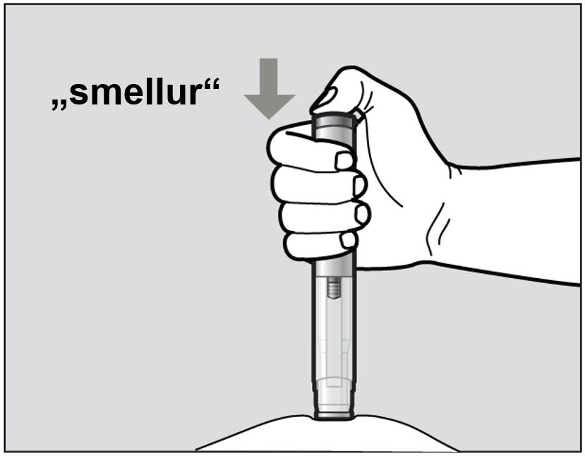 Mynd J Fjólublái flöturinn færist eftir glugganum meðan á inndælingunni stendur (sjá mynd K).