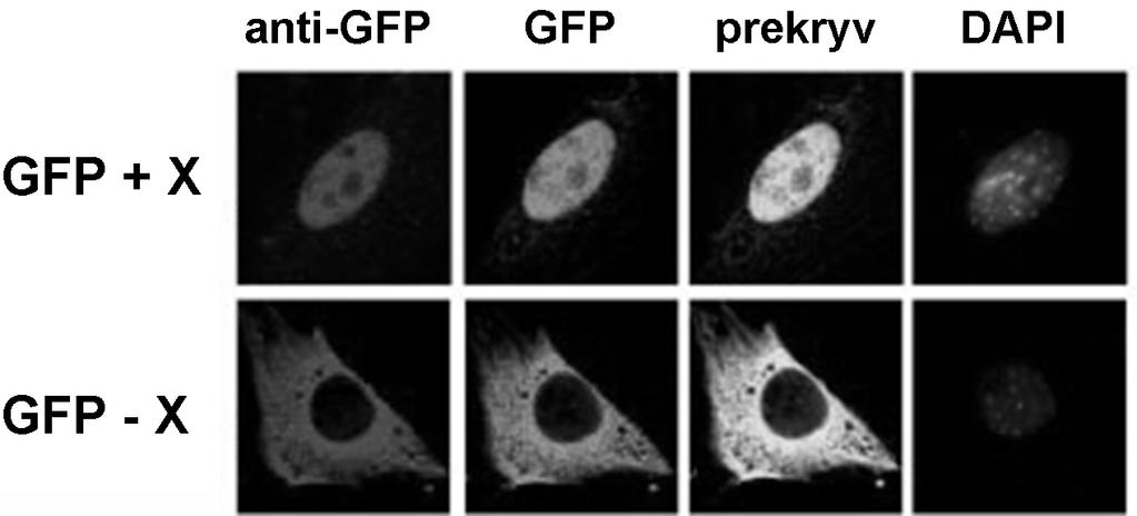 Obr. 3: Expresia faktora X fúzovaného s GFP, farbené s DAPI. X+GFP bol exprimovaný z expresného vektora v bunkovej kultúre ľudských fibroblastov (horný panel).