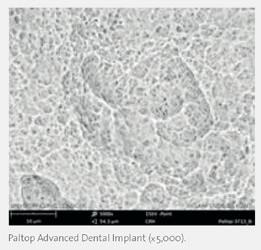 Από το 2015, η PALTOP εισήγαγε τα εμφυτεύματα PALTOP CONICAL Active (PCA), με μοναδικό γεωμετρικό σχεδιασμό και την καινοτομική ΚΩΝΙΚΗ σύνδεση 22⁰ που παρέχουν την απόλυτη βιολογική απόφραξη και