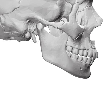 CORTICAL & CANCELLOUS PARTICULATE - MIX Mineralized (FDBA, MIX) Παρέχει τις μηχανικές ιδιότητες της ενασβεστιωμένης φλοιώδους οστικής δομής σε συνδυασμό με την υψηλή αγγειογενετική δυνατότητα της