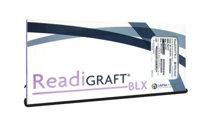 0,50 cc 1,00 cc 2,00 cc με διάσταση κόκκων 250-1000 μm ReadiGraft blx DBM Putty Βέλτιστη έκθεση των αυξητικών παραγόντων Φυσικός φορέας ανθρώπινου ιστού Μορφοποιήσιμο, με εξαιρετικές ιδιότητες