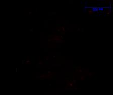 Inhibition of CK1δ/CK1ε has no
