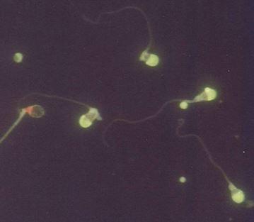 Određivanje stanja akrosoma Membrana akrosoma obojena pomoću Pisum sa(vum