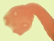 8 Εικόνα12. Σκωληκοκεφαλή Taenia saginata (Πηγή: Division of Parasitic Diseases, CDC) ΘΕΡΑΠΕΙΑ Θεραπευτικά χορηγούνται η νικλσαμίδη ή η πραζικουαντέλη από το στόμα, σε μια εφάπαξ δόση.