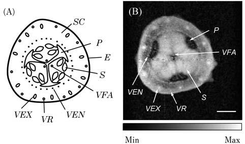 148 /0 - **3-30 T T ImageJ T TE MIP maximum intensity projection : ImageJ T MRI Fig. TR s TE.* ms -0. mm 2. mm TR s TE.* ms 2* ms. Fig. TR / s *.- s TE 1 ms* ms T MRI Fig.