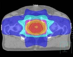 trials showing OS benefit with dose