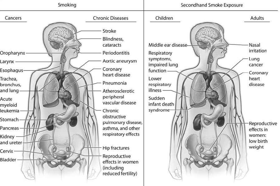 Tobacco use damages every part of the body, including respiratory system Source: WHO Report