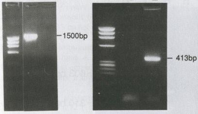 Η PCR έχει χρησιµοποιηθεί ευρύτατα για τη διάγνωση παρασιτώσεων. Οι απλές ποσοτικές PCR αναφέρονται σαν ηµιποσοτικές τεχνικές, στις οποίες γίνεται ανάλυση των τελικών ενισχυµένων προϊόντων.