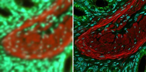 Σύγκριση εικόνων widefield και confocal Images of 20 μm thick mouse intestine section Images of a triple-labeled mouse intestine section Images of a 20 μm thick
