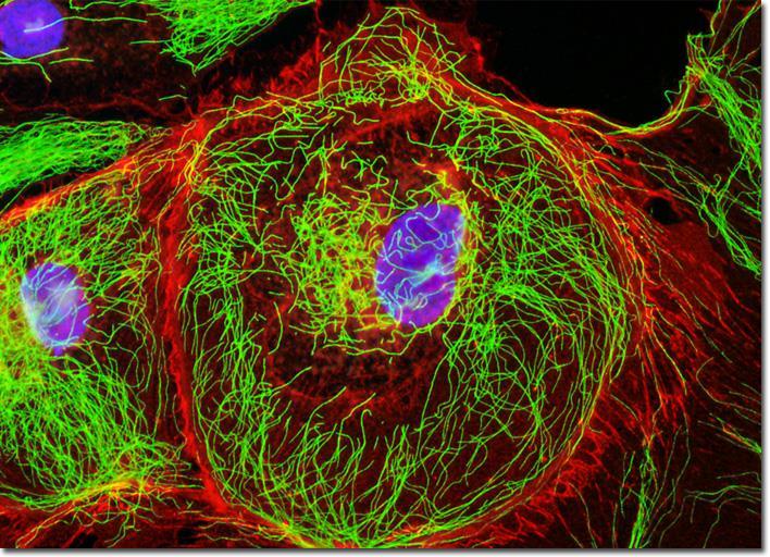 Ποια ερωτήματα πρέπει να μπορούμε να απαντάμε; Επιθηλιακά κύτταρα νεφρού ποντικού https://micro.magnet.fsu.edu/primer/techniques/fluorescence /gallery/cells/ptk2/ptk2cellsexlarge2.